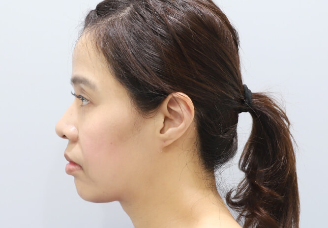 Before Image