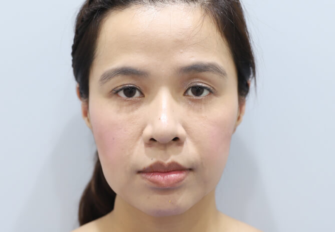 Before Image