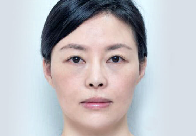 Before Image