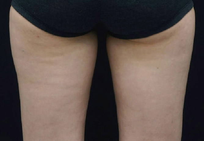 After Image