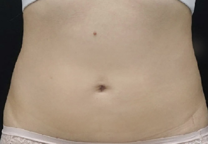 After Image