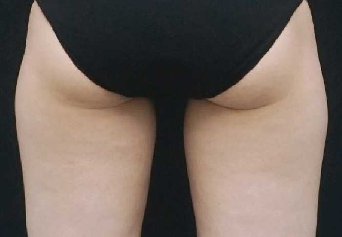 After Image