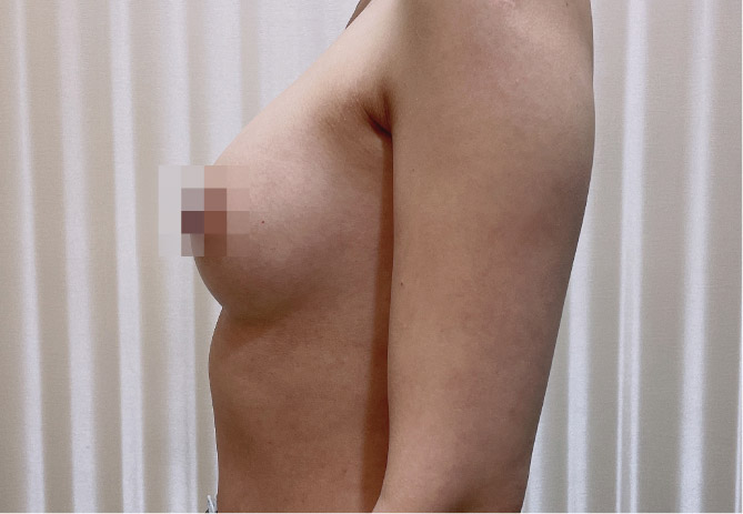 After Image