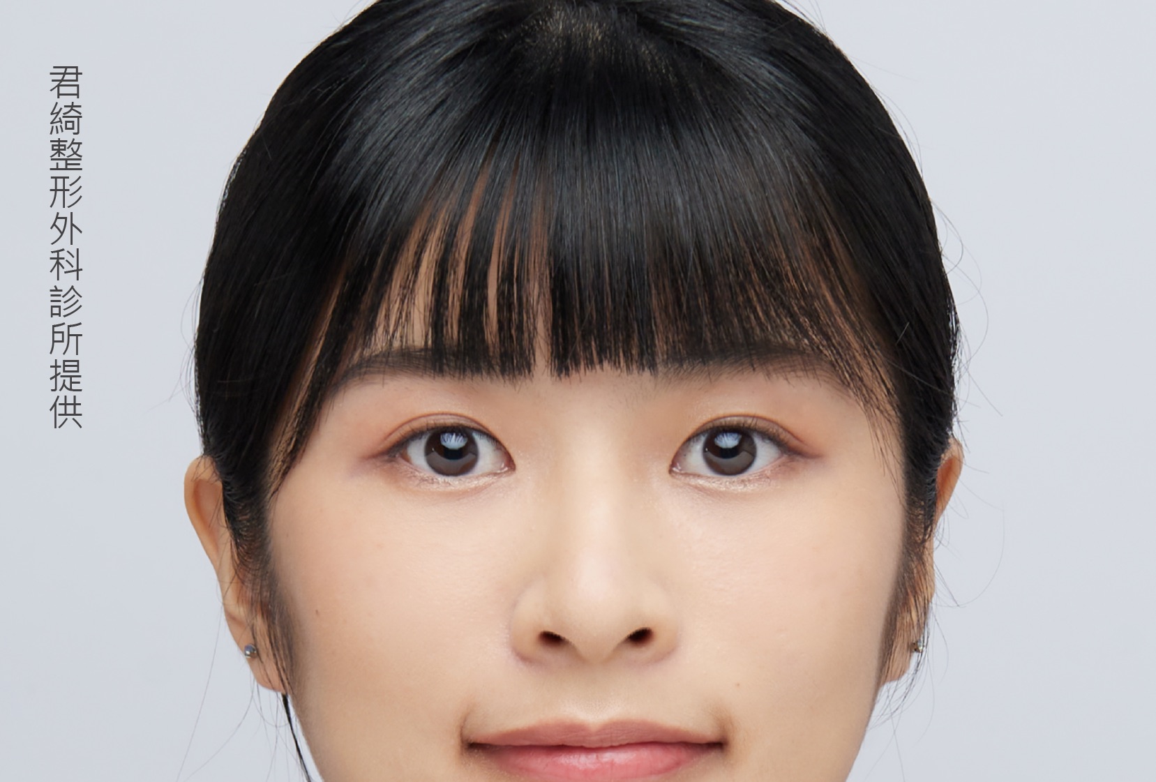 After Image