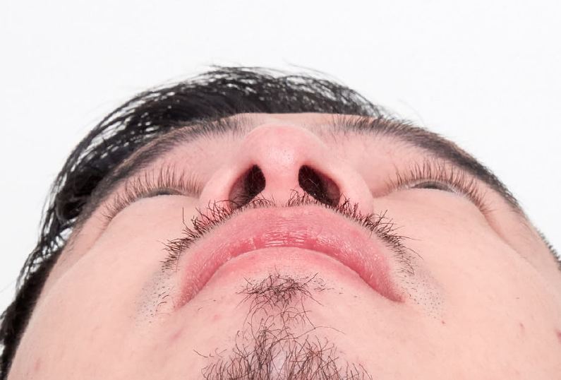After Image