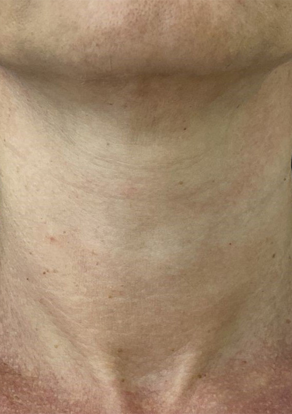 After Image
