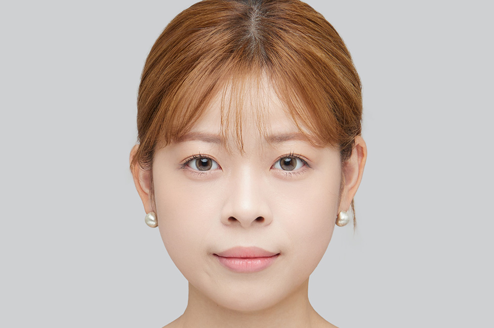 After Image