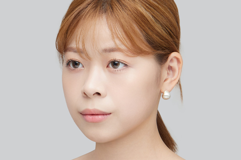 After Image