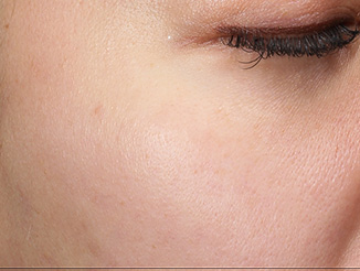After Image